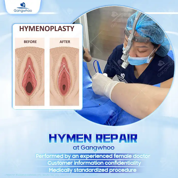 Top 7 safe hymen repair addresses in Ho Chi Minh City with reasonable costs