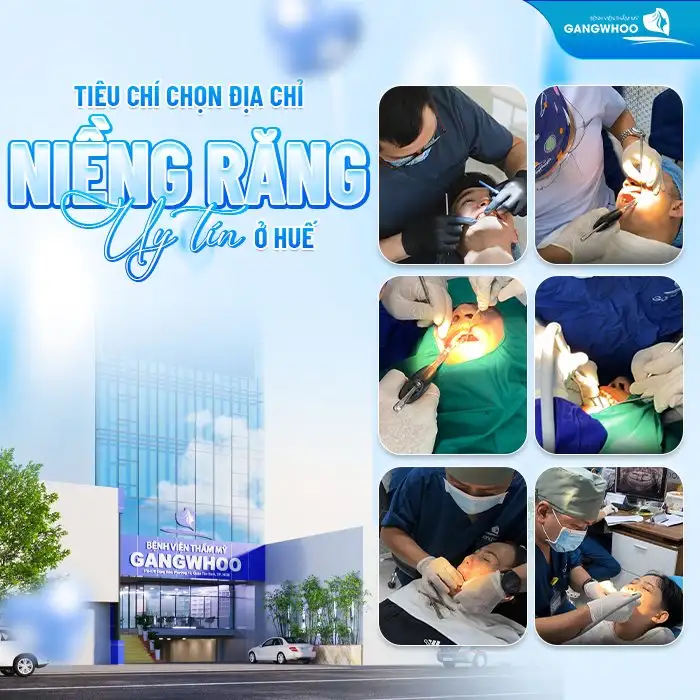 Tiêu chí chọn địa chỉ niềng răng uy tín ở Huế