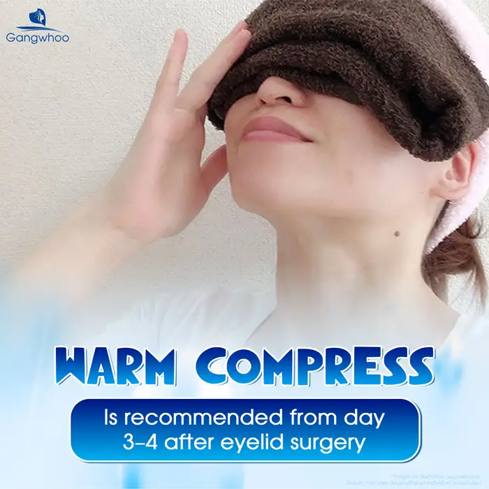 Instructions on how to apply cold compresses after double eyelid surgery to effectively reduce swelling