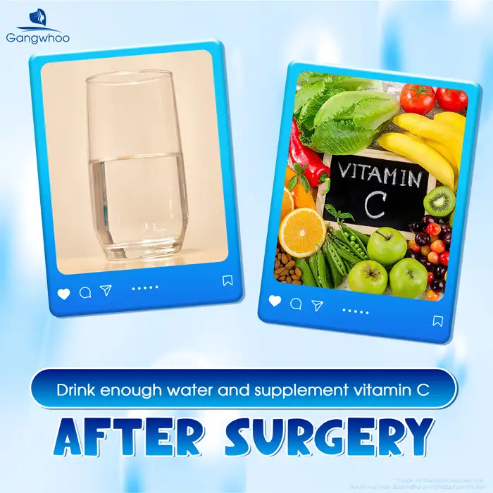 Instructions on how to apply cold compresses after double eyelid surgery to effectively reduce swelling