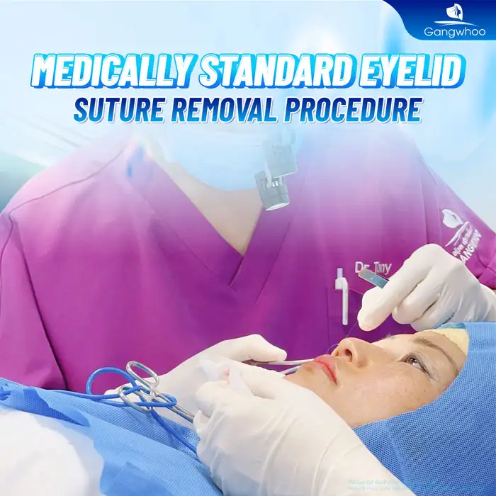 How is medically standard eyelid suture removal performed? How to care for the eyelids after suture removal