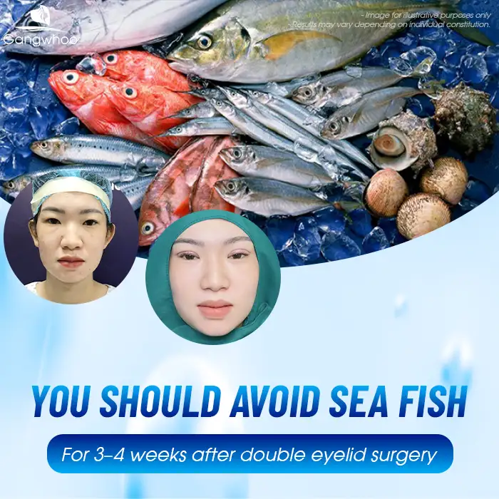 Can You Eat Sea Fish After Double Eyelid Surgery? Does It Cause Eyelid Swelling?