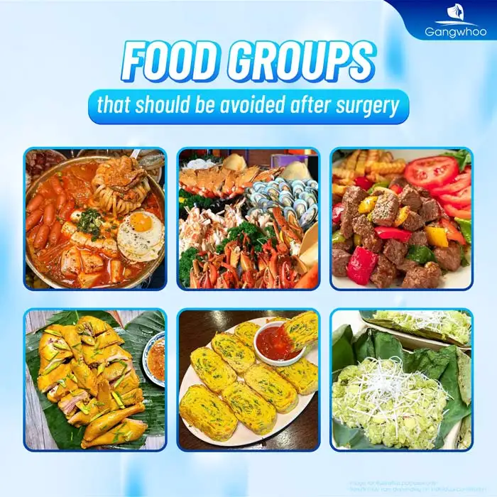 Can you eat bamboo shoots after eyelid surgery? Does it affect the wound?