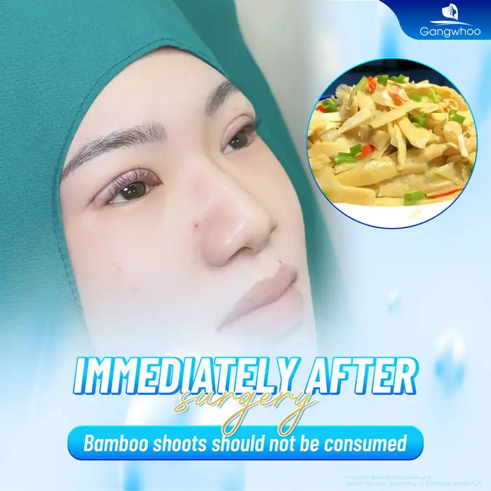 Can you eat bamboo shoots after eyelid surgery? Does it affect the wound?