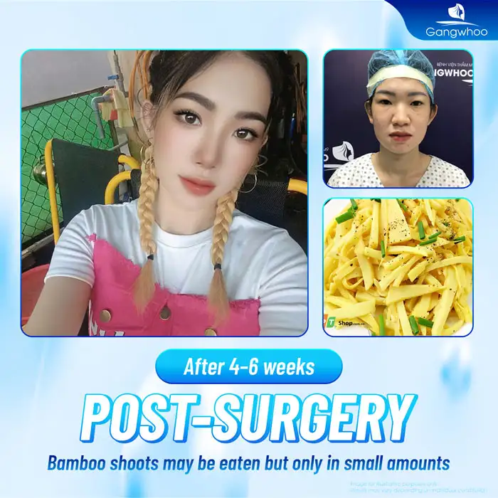 Can you eat bamboo shoots after eyelid surgery? Does it affect the wound?