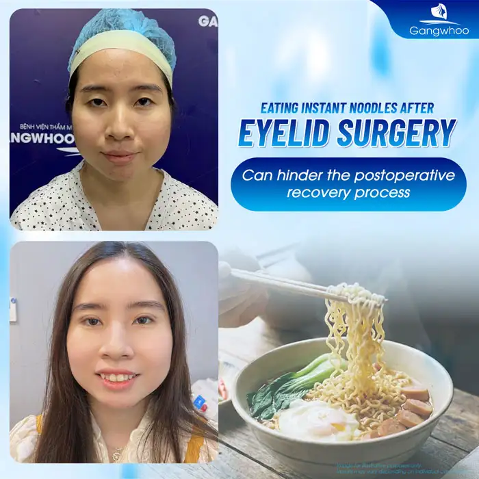 en cat mi an mi tom duoc khong 3