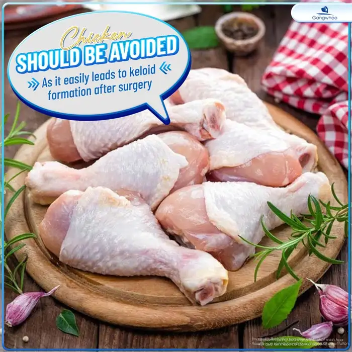 How long after double eyelid surgery can you eat chicken to avoid swelling