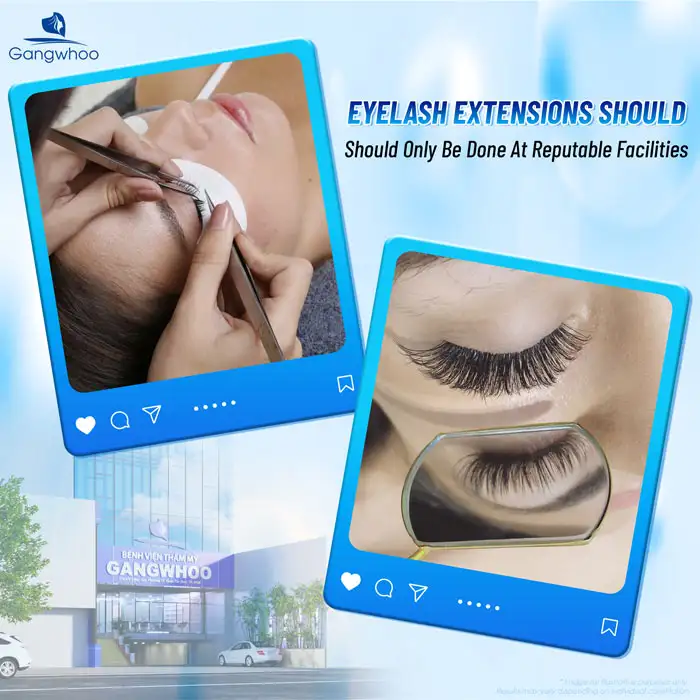 How Long After Eyelid Surgery Can You Get Eyelash Extensions? Important Notes for Eyelash Extensions After Eyelid Surgery