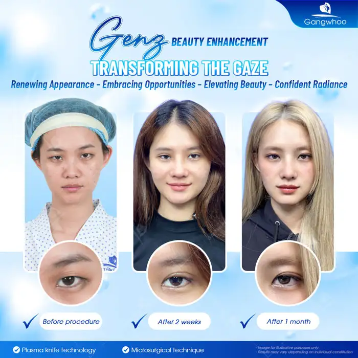 How long does it take for scars to fade after eyelid surgery? Ways to help scars fade faster after eyelid surgery