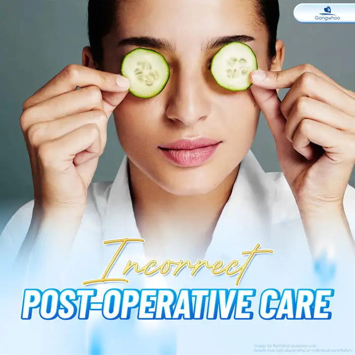 How long does eyelid surgery swelling last? What are effective ways to reduce swelling?