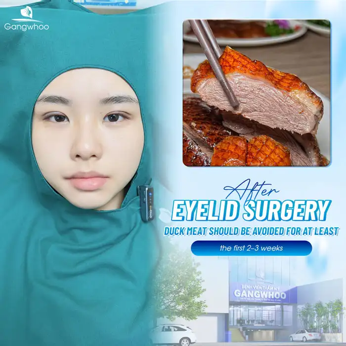Can you eat duck meat after eyelid surgery? How long should you avoid duck meat?