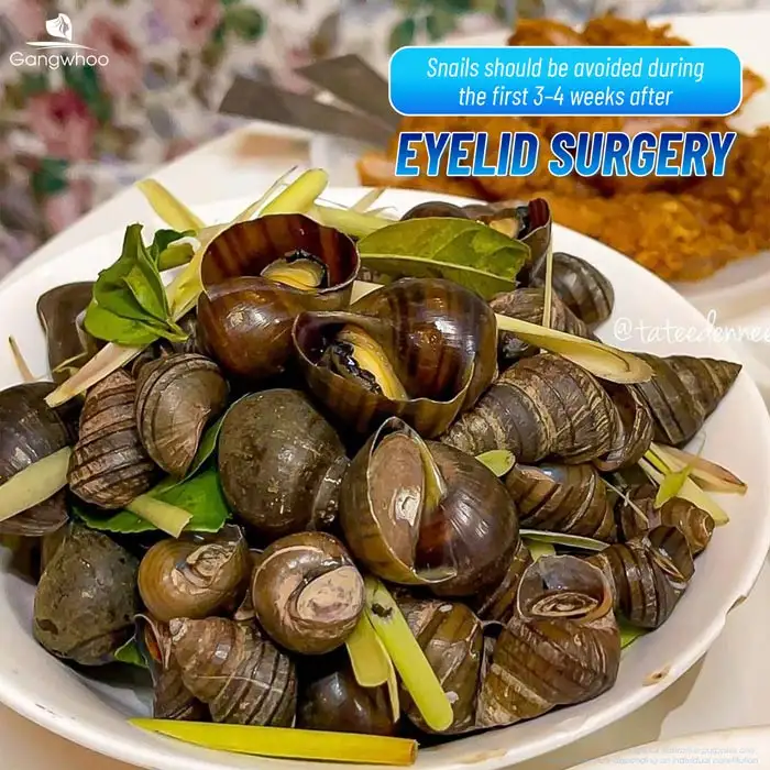 Can You Eat Snails After Double Eyelid Surgery? How Long Should You Avoid Them?