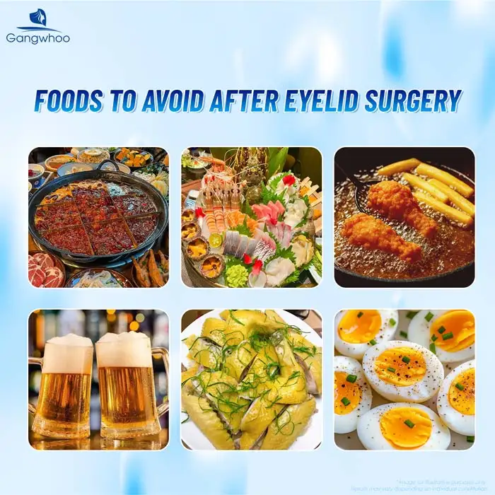 Can You Eat Snails After Double Eyelid Surgery? How Long Should You Avoid Them?