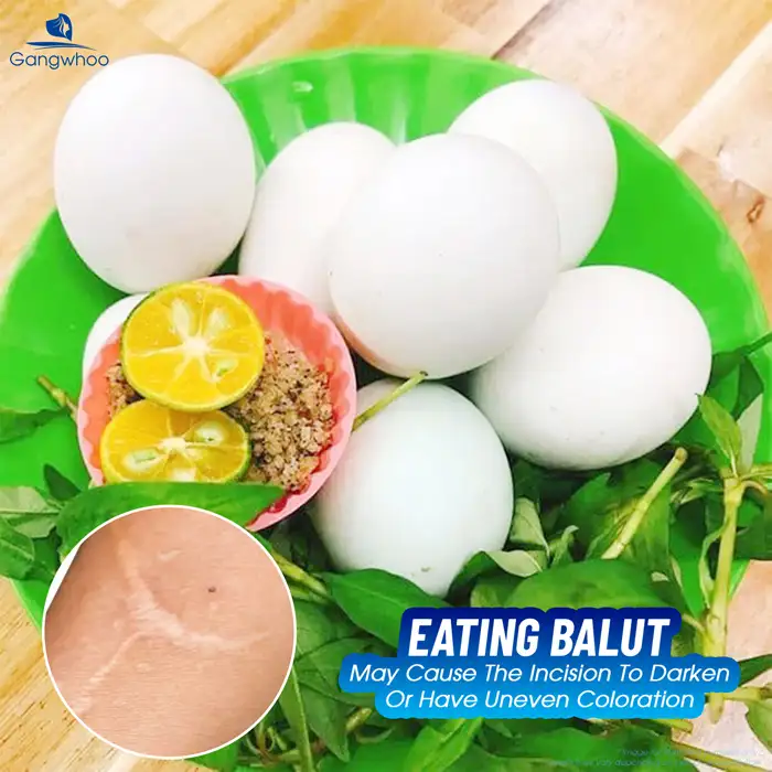 Can you eat balut after double eyelid surgery? Does it have any effect?