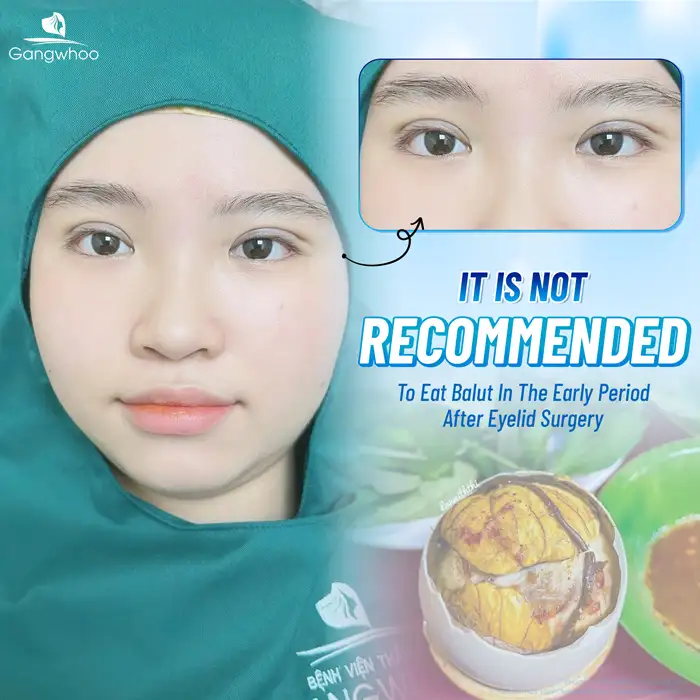 Can you eat balut after double eyelid surgery? Does it have any effect?