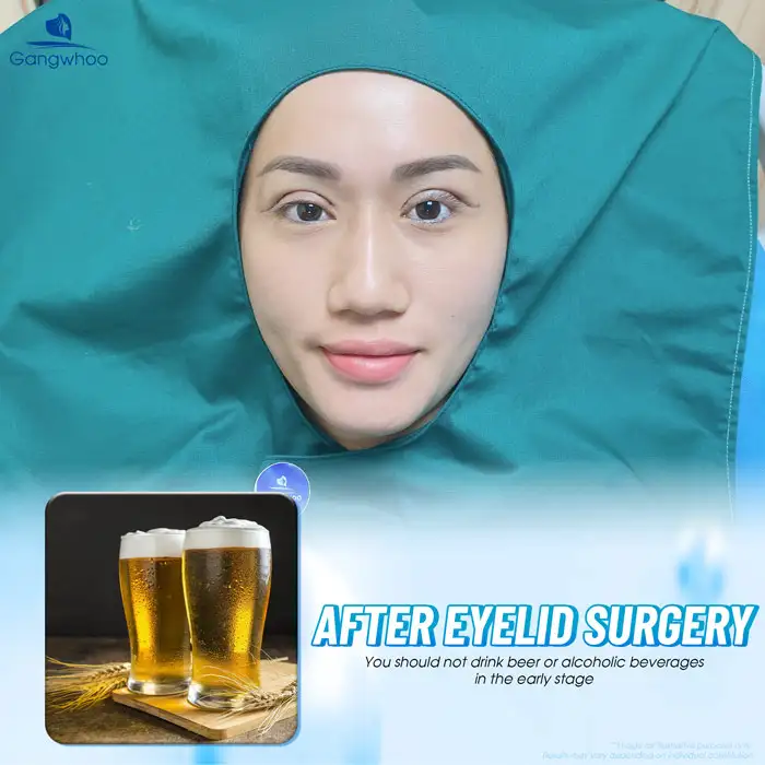 Is It Okay to Drink Beer After Eyelid Surgery? How Long Should Alcohol Be Avoided After Double Eyelid Surgery?
