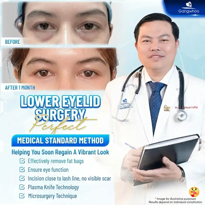 Does lower eyelid surgery leave scars? What are the causes of scarring?