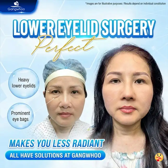 Lưu nháp tự động