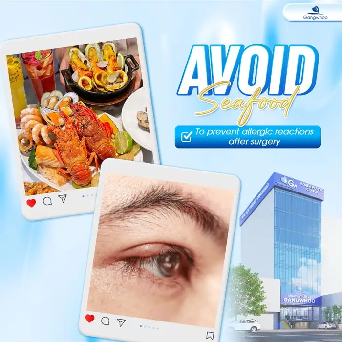 Cut eyelid surgery: How long should seafood be avoided? Why is it necessary to avoid seafood?