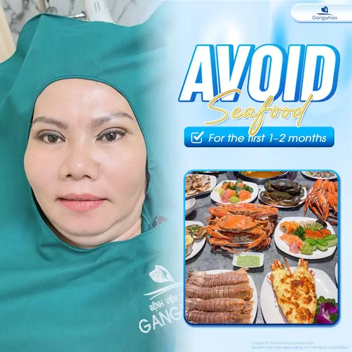 Cut eyelid surgery: How long should seafood be avoided? Why is it necessary to avoid seafood?