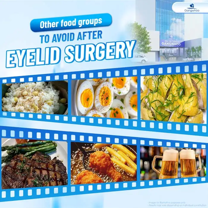 Cut eyelid surgery: How long should seafood be avoided? Why is it necessary to avoid seafood?