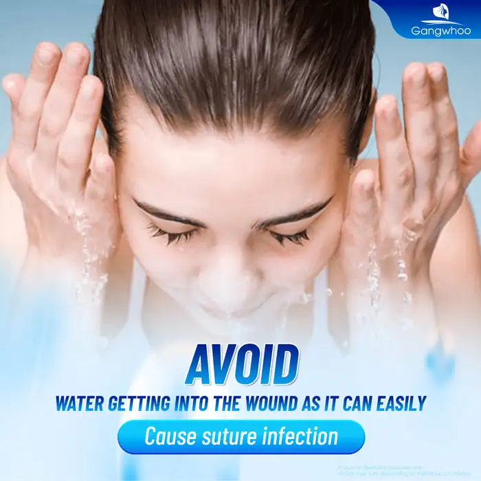 How long should you avoid water after double eyelid surgery? Why is water avoidance necessary after double eyelid surgery?