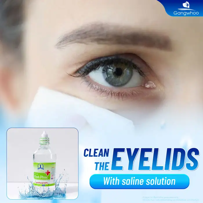 How long should you avoid water after double eyelid surgery? Why is water avoidance necessary after double eyelid surgery?