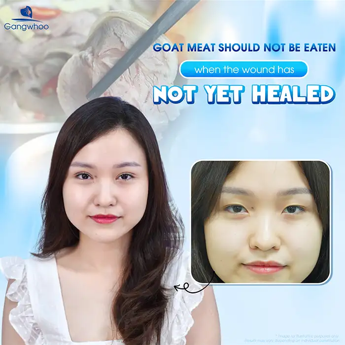 Can You Eat Goat Meat After Eyelid Surgery? How Long Should You Avoid Goat Meat?