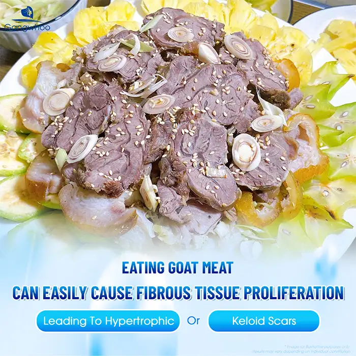 Can You Eat Goat Meat After Eyelid Surgery? How Long Should You Avoid Goat Meat?