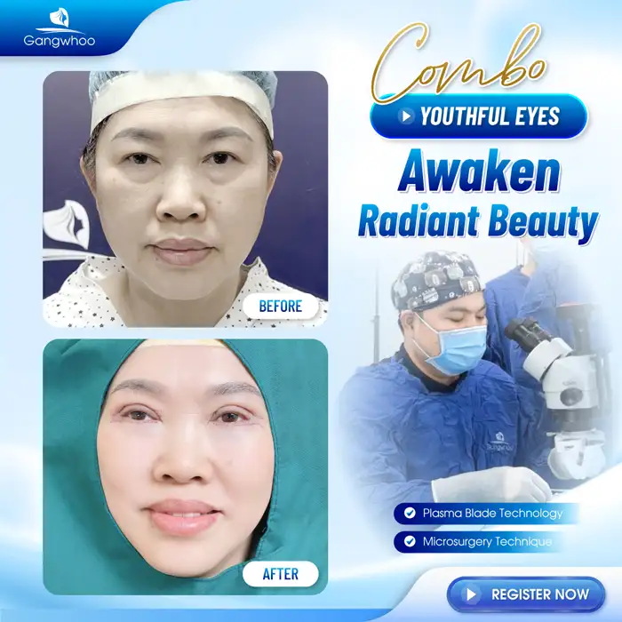 Does eyelid surgery leave scars? What factors cause scarring?