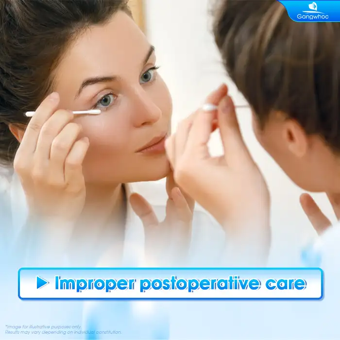 Why Is There Uneven Swelling After Double Eyelid Surgery? How Should It Be Managed?