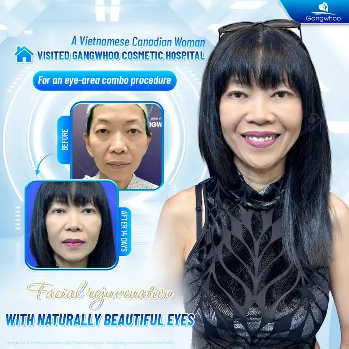 What is the lower eyelid fat removal method? How is the procedure performed?