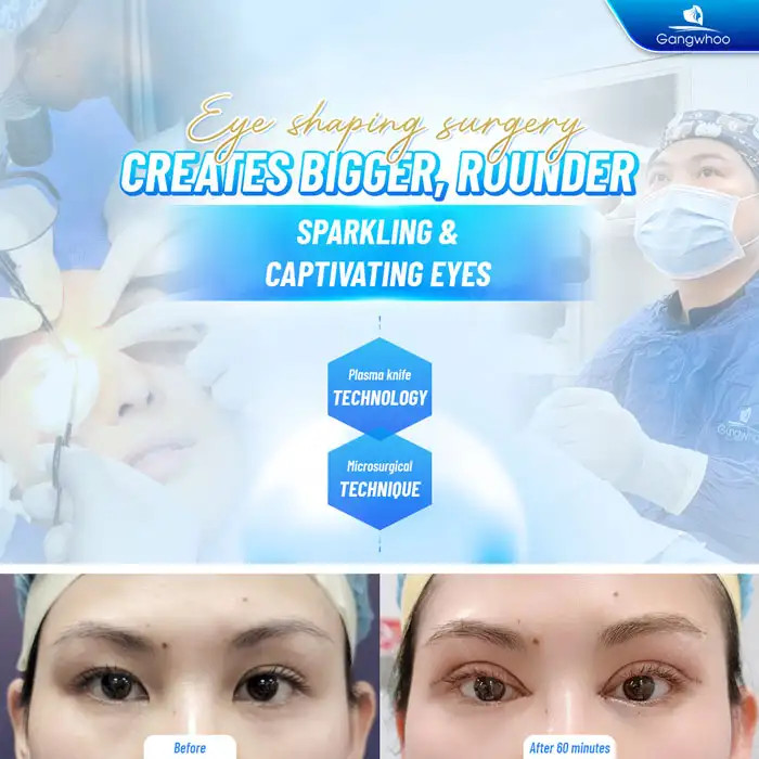 How much does Plasma eyelid surgery cost? Latest price list update 2026