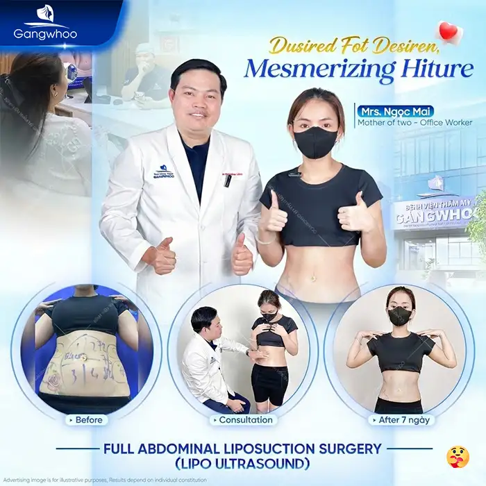 What Is Ultrasound-Assisted Liposuction? Is It Safe and Effective?