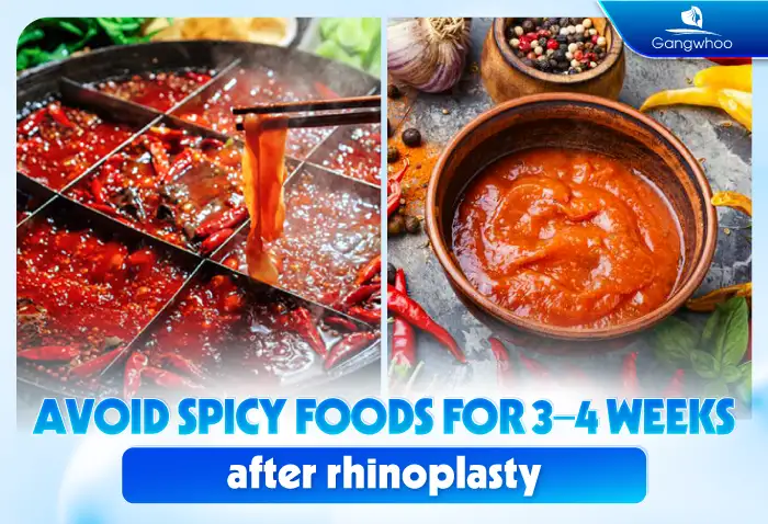 Is it harmful to eat spicy food after rhinoplasty? Should spicy seasonings be used?