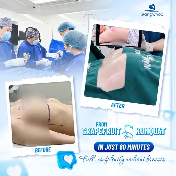 Breast Augmentation: Is It Dangerous? Possible Complications You Should Know