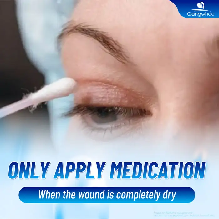 Top 3+ Scar-Healing Medications After Double Eyelid Surgery? Notes When Using 4 Top 3+ Scar-Healing Medications After Double Eyelid Surgery? Notes When Using