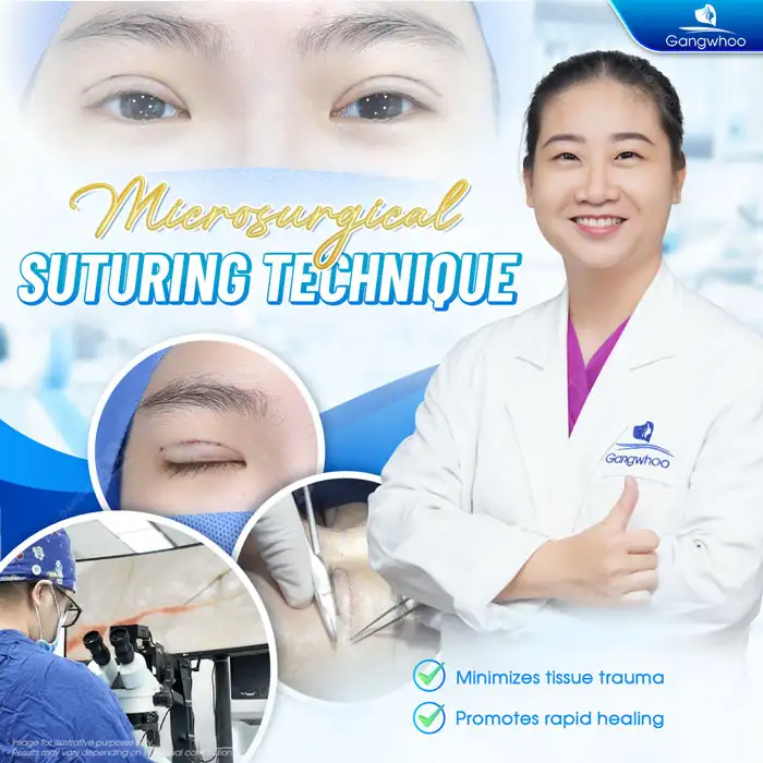 Does Eyelid Suture Removal Hurt? Does It Cause Any Effects?