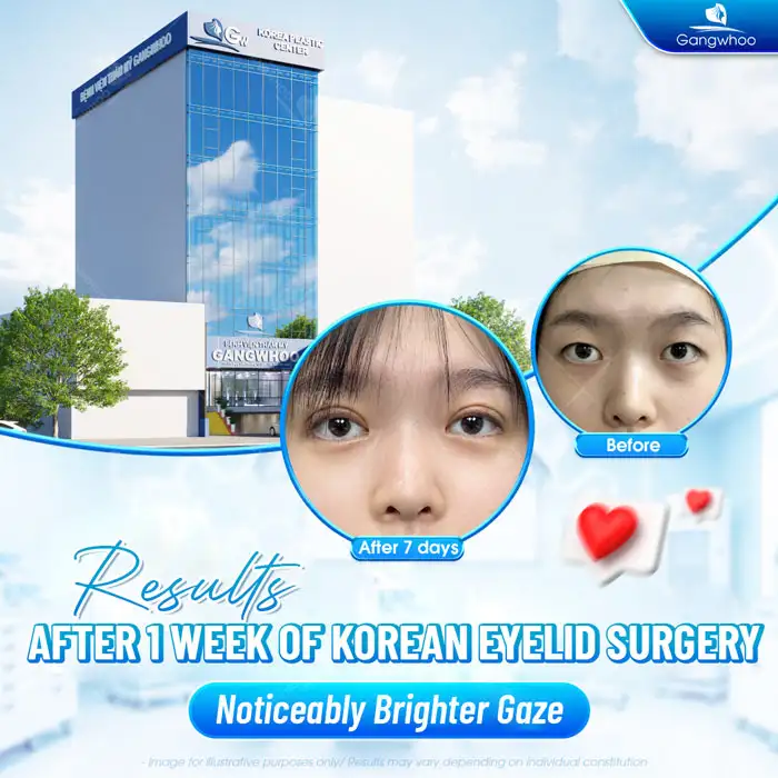Does Eyelid Suture Removal Hurt? Does It Cause Any Effects?