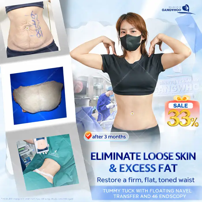Is Abdominoplasty or Abdominal Liposuction Better? Which Method Is Most Effective?