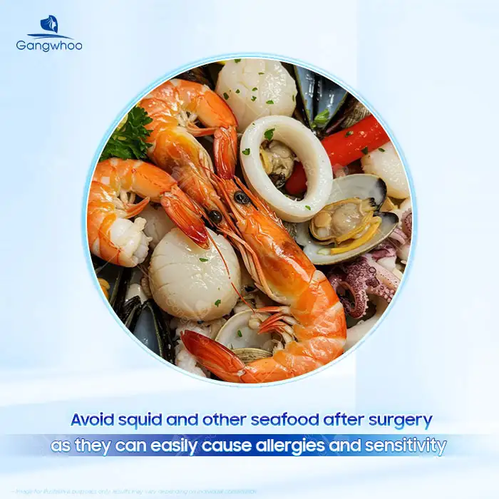 Can You Eat Squid After Double Eyelid Surgery? How Long Should You Wait Before Eating Squid?