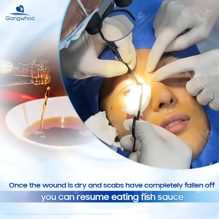 Can You Eat Fish Sauce After Double Eyelid Surgery? How Long Should You Avoid It?