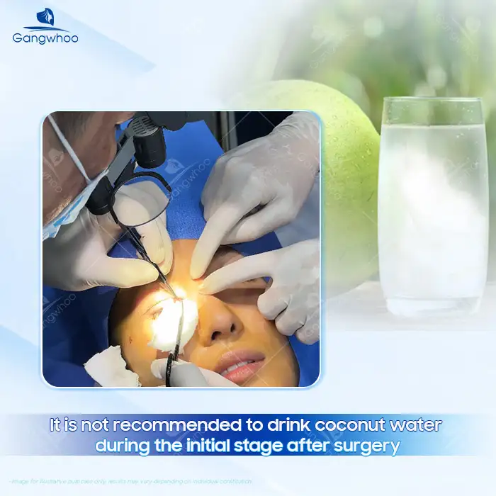 After Double Eyelid Surgery, Can You Drink Coconut Water? Does It Have Any Effects?