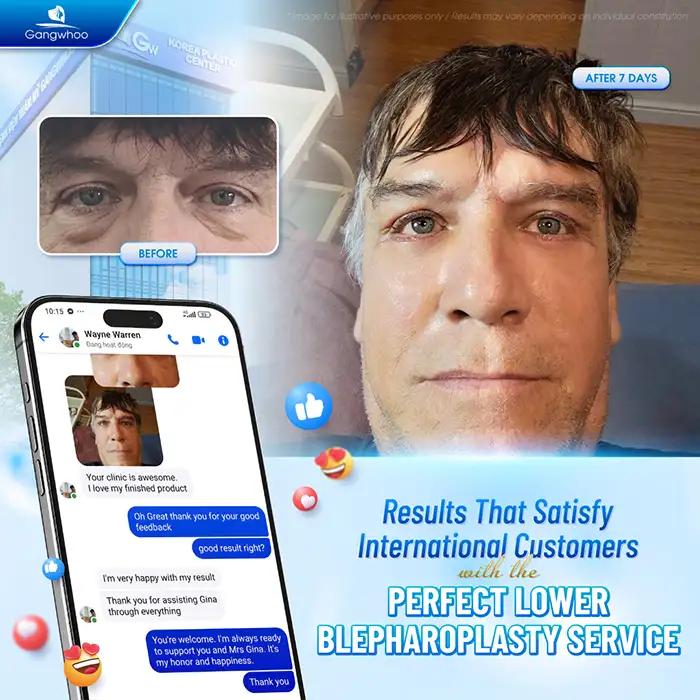 Lower eyelid surgery cost? Latest lower eyelid surgery price list 2025