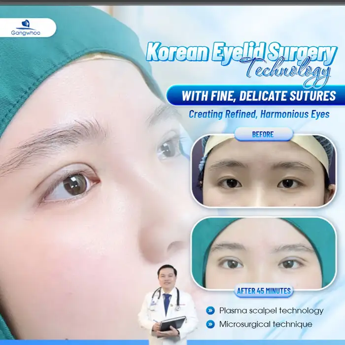 Where Is the Best Place for Eyelid Surgery? 11+ Reputable and Best Eyelid Surgery Addresses in Ho Chi Minh City