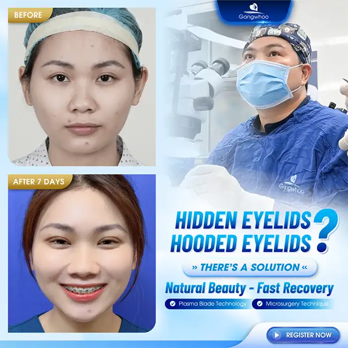 Have the wounds fully healed and stabilized 6 months after double eyelid surgery?
