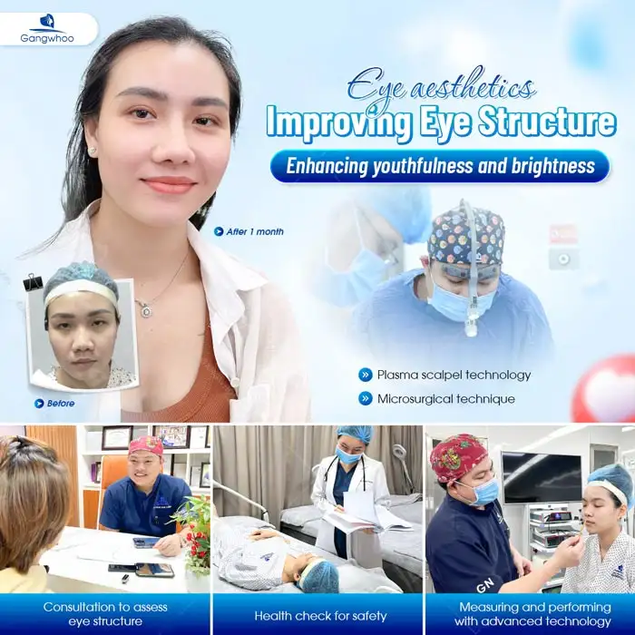 Eye aesthetic surgery improves eye structure and enhances a youthful, radiant gaze
