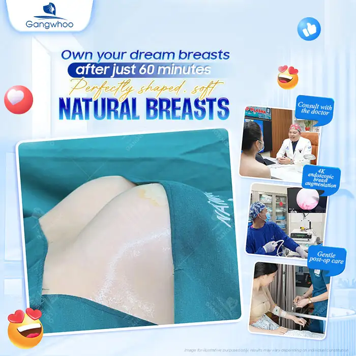 Achieve beautifully shaped breasts as desired after only 60 minutes