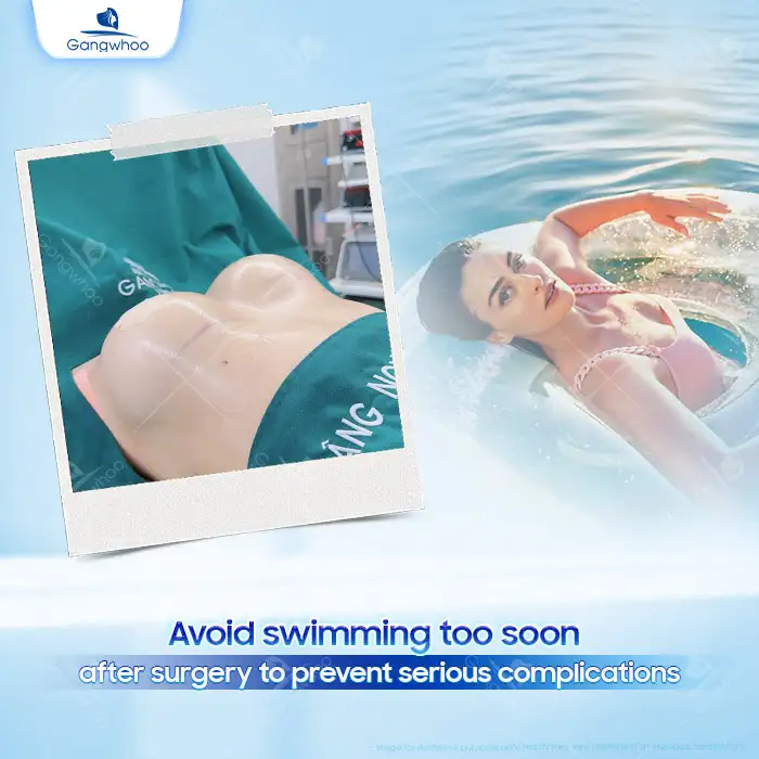 How Long After Breast Augmentation Can You Go Swimming? Important Precautions When Swimming