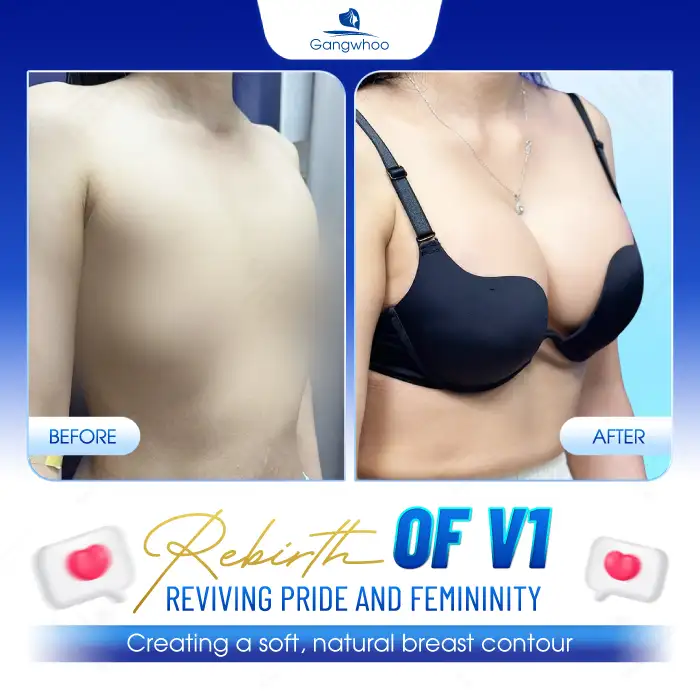 Is endoscopic breast augmentation painful? What should be noted?